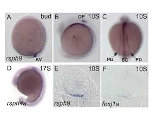 重续“活下去”的希望！55岁失独母亲供卵试管婴儿生子
