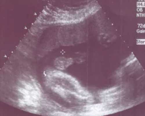 沈阳供卵快的医院-做供卵的女人