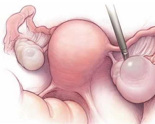 沈阳代孕中心供卵-供卵助孕收费