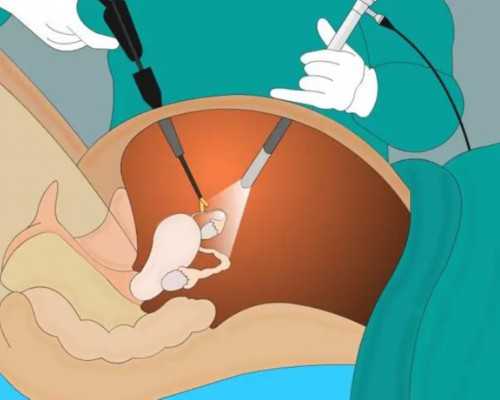 北京供卵试管婴儿医院排名,北京供卵哪家医院好_供卵试管好找