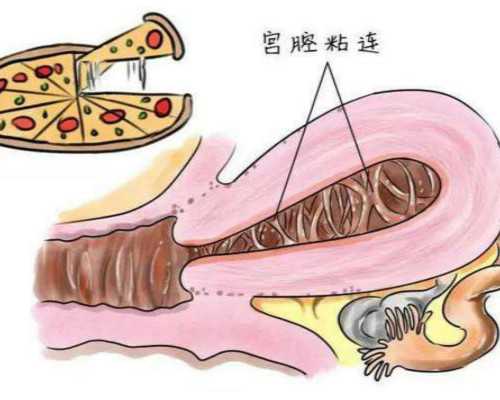 代怀靠谱医院,五种怪味食物,备孕助孕有一套!