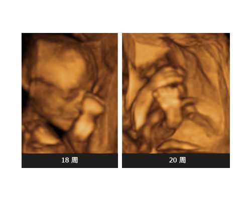 试管代孕医院花费,义乌哪家医院做试管婴儿助孕技能好?