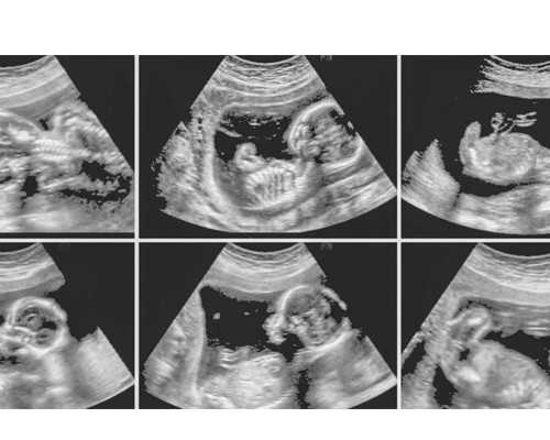 上海供卵试管费用是多少钱,一妇婴能不能做供卵试管?上海哪家医院能做供卵